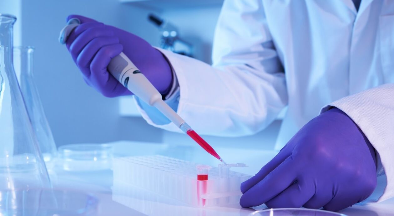 How to do parasites analysis