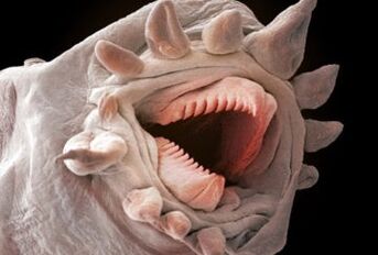 what worms can live in the human body