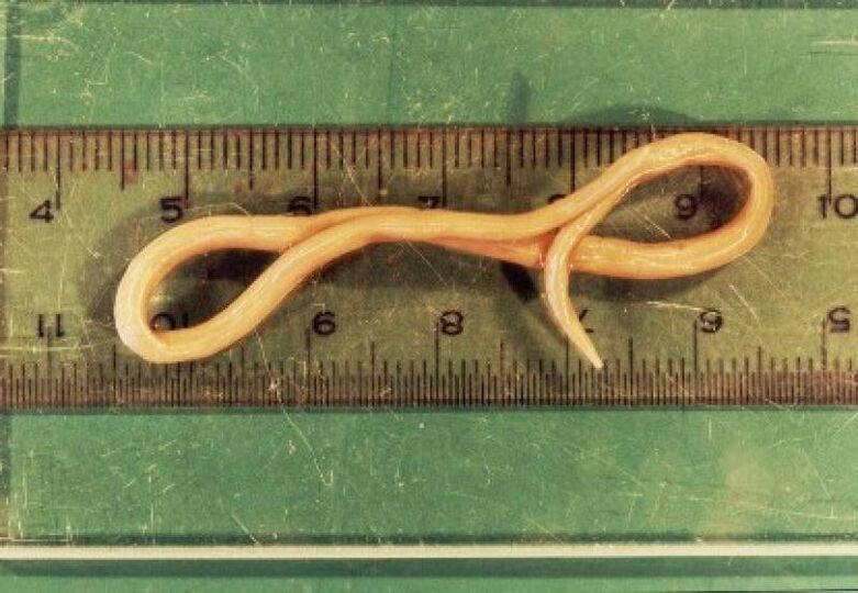a roundworm parasite of the human body