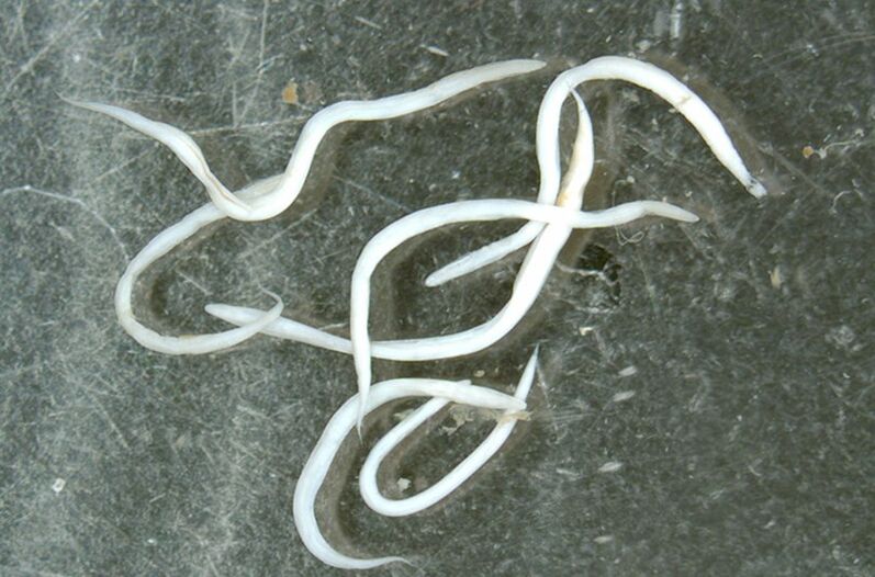 a worm parasite of the human body