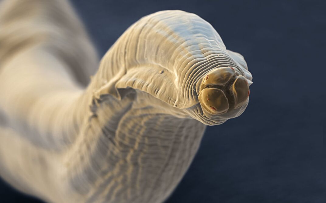 taxi from the human body