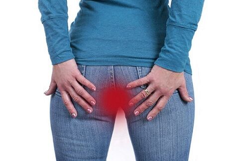 itching in the anus as an indication for examination for parasites