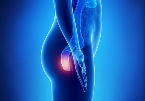 itching in the rectum as an indication for examination for parasites